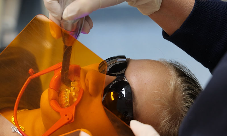 Why Are Retainers Important After Orthodontic Treatment?